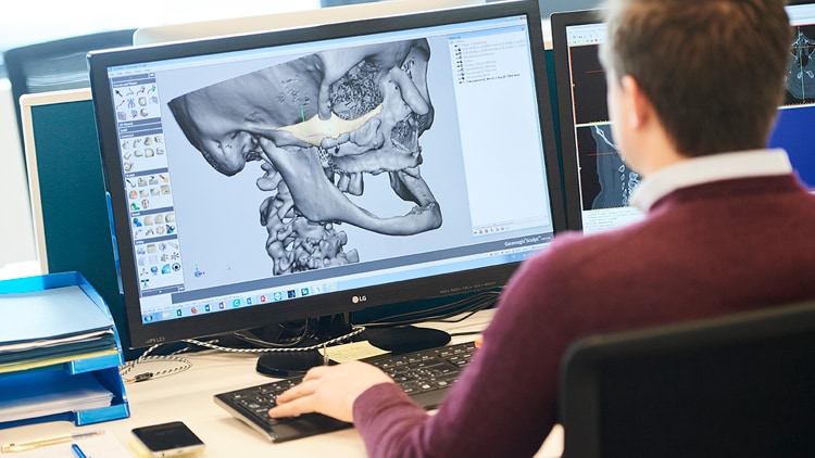 Creating the blue print for teeth prosthetic - Client case study CADskills